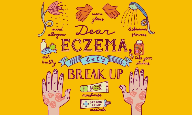 How to treat eczema rash in summer?