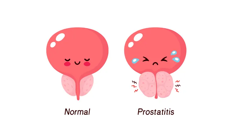 Homeopathy treats prostatic hyperplasia