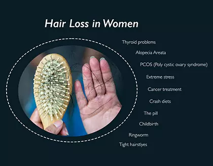 How To Control Hair Fall In Women - Dr. Batra's® Homeopathy