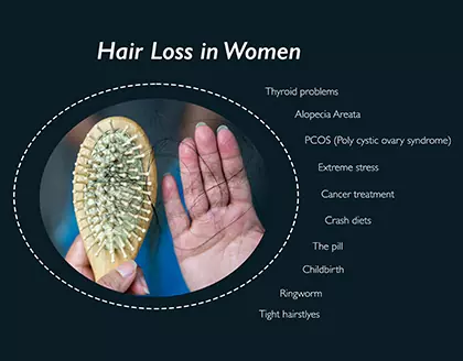 How To Control Hair Fall In Women - Dr. Batra's® Homeopathy How To Control Hair Fall In Women - Dr. Batra's® Homeopathy