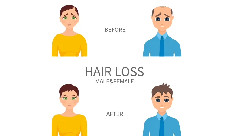 How does non-surgical hair replacement work?