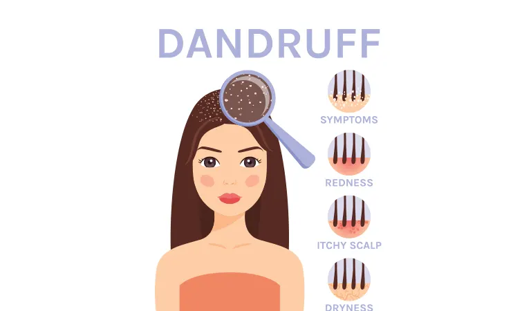 How to control dandruff with Dr Batra's® New Hair treatment?