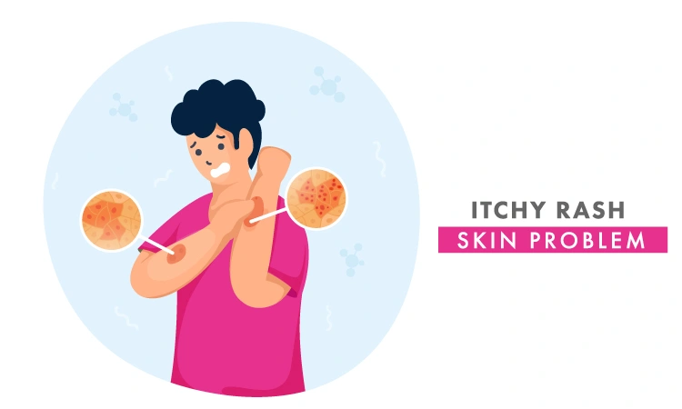 Can lichen planus cause skin rash?