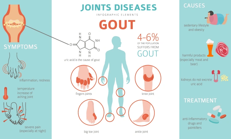 Use homeopathy to ease gout pains
