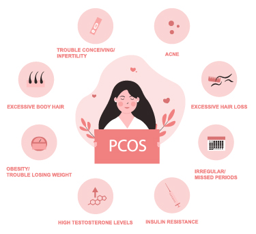 Polycystic Ovarian Syndrome - PCOS Causes in Women - Dr Batra's®