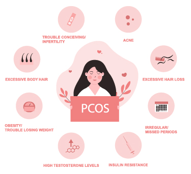 Polycystic Ovarian Syndrome - PCOS Causes in Women - Dr Batra's® Polycystic Ovarian Syndrome - PCOS Causes in Women - Dr Batra's®
