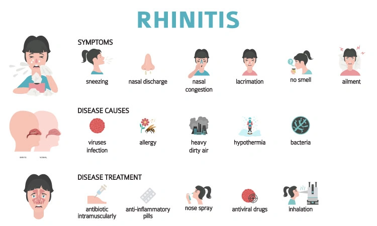 All You Need To Know About Allergic Rhinitis