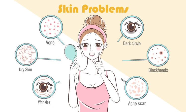 Common skin problems during the monsoons