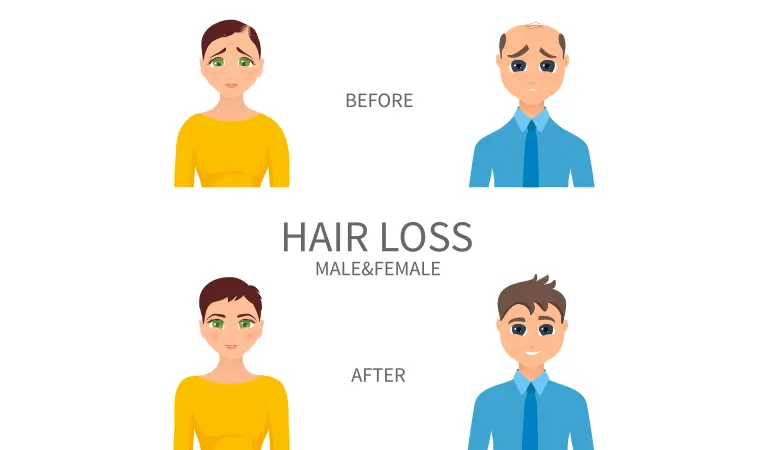 Top 5 hair regrowth success stories - Dr Batra's® Top 5 hair regrowth success stories - Dr Batra's®