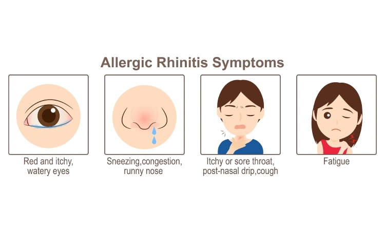 Do You Have Allergic Rhinitis or Cold?