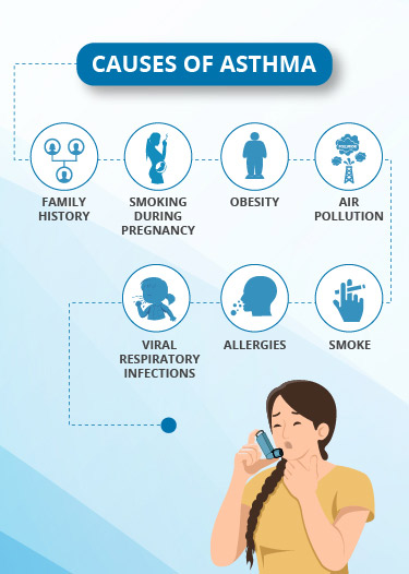 Asthma Treatment