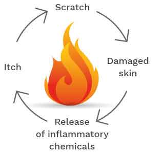 common-system-exzema-1.jpg
