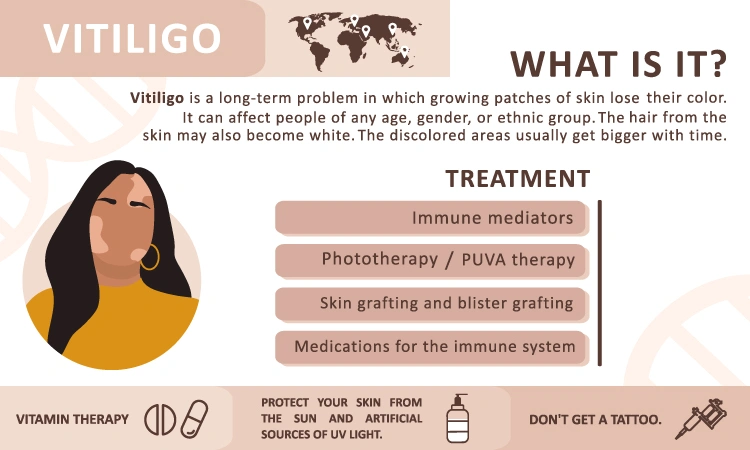Homeopathy - Most effective treatment for vitiligo