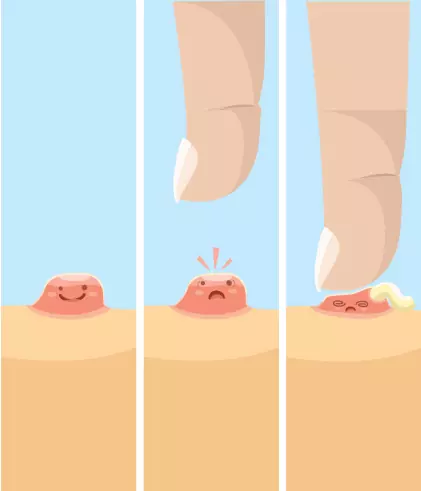 Can popping a pimple lead to acne scars? - Dr Batra's Can popping a pimple lead to acne scars? - Dr Batra's
