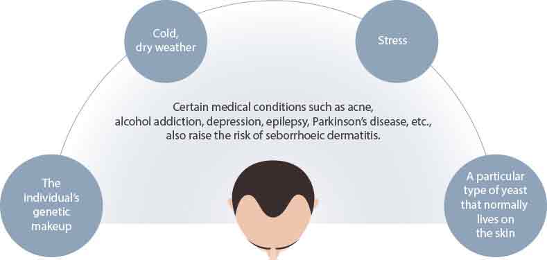 seborrheic-dermatitis_causes_1