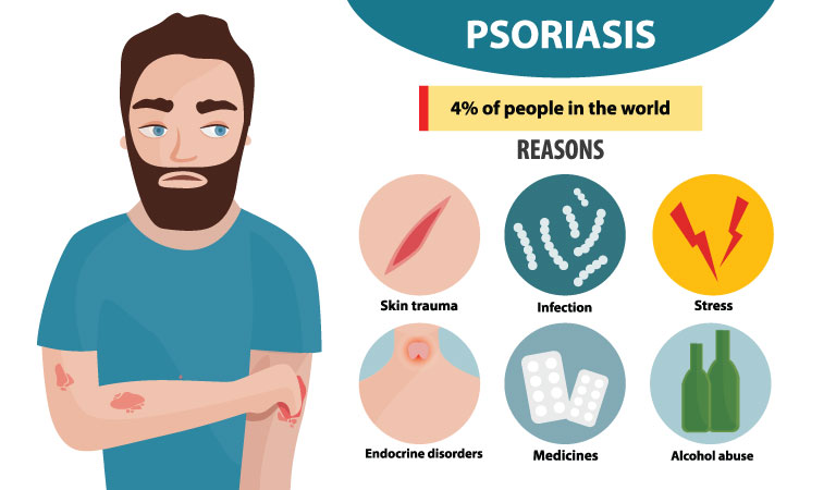 Itching to deal with psoriasis? Try homeopathy