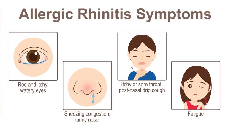 Get rid of Allergic Rhinitis symptoms with homeopathy