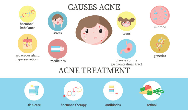  Acne can be painful too! Try homeopathy