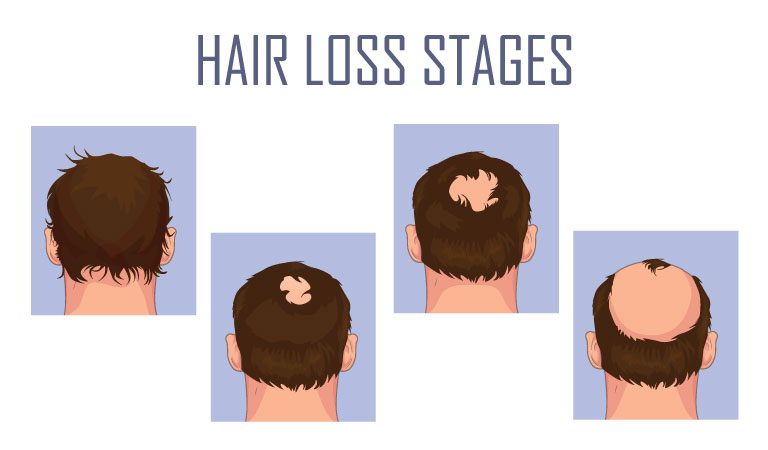 Shampoo and hair washing myths debunked