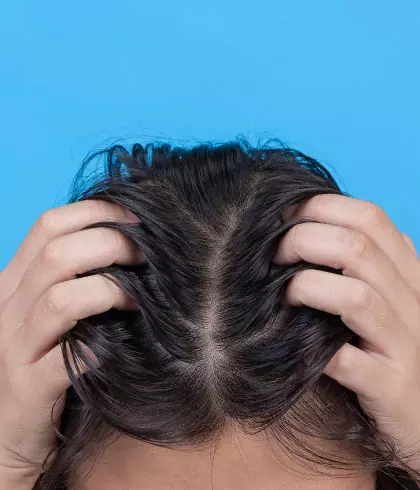 Hair pulling disorder: Causes & Treatments