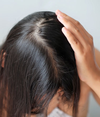 Apple cider vinegar for hair fall | Dr Batra's™ Apple cider vinegar for hair fall | Dr Batra's™