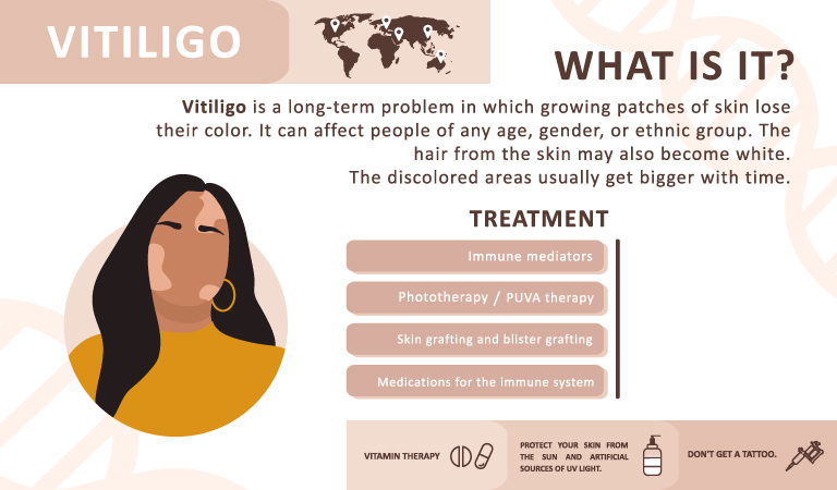 Homeopathy Most Effective Treatment For Vitiligo Dr Batraтащsтдв Homeopathy Most Effective Treatment For Vitiligo Dr Batraтащsтдв