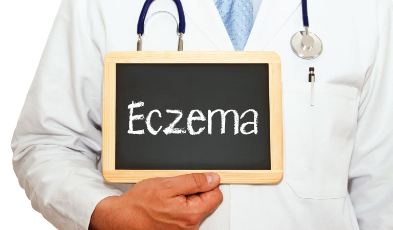 Eczema triggers and how to avoid them?