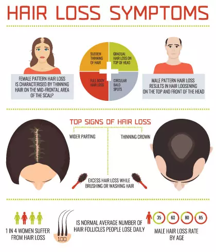 Genetic Pattern Hair Loss Beverly Hills  Receding Hairline Causes Los  Angeles