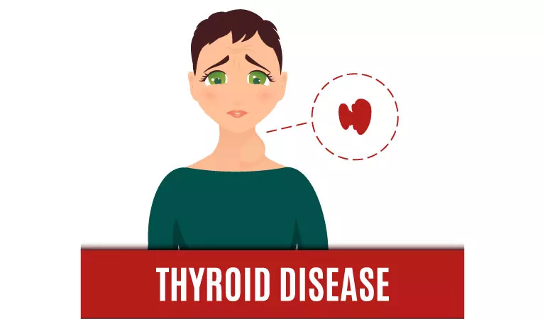 Thyroid disorders – Types and homeopathy treatment