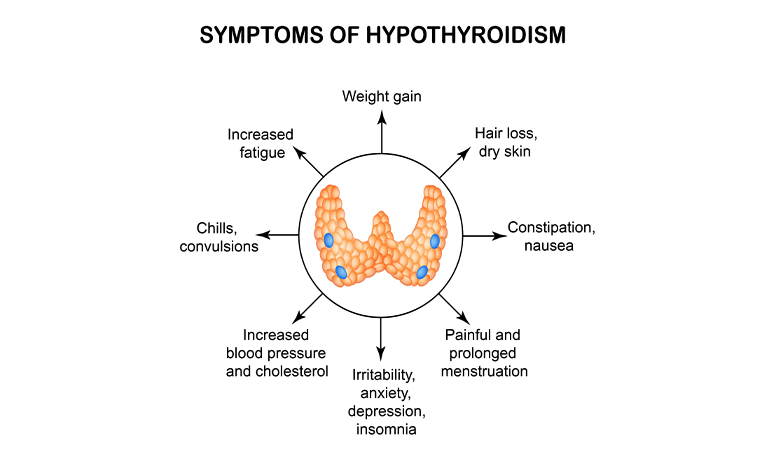 Hipotiroidismo y amenorrea