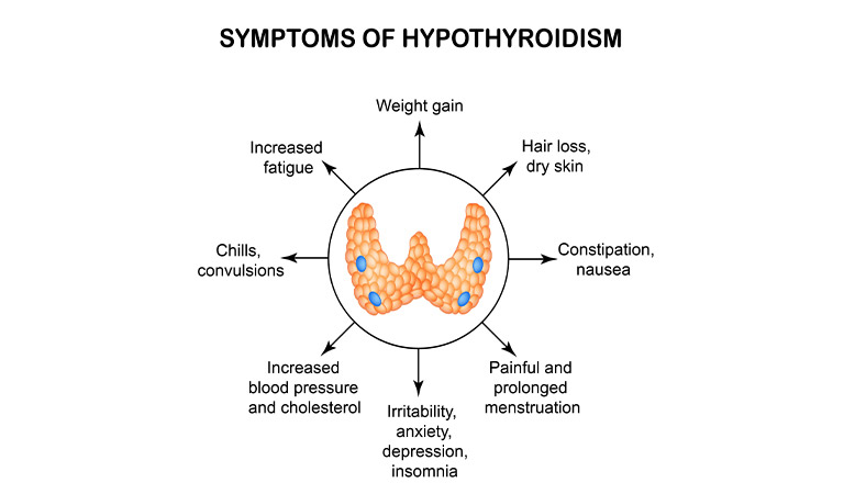 Role of homeopathic doctors in thyroid management