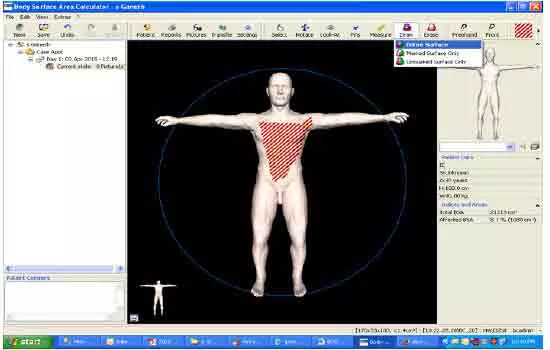 skin-surface-area-measurement