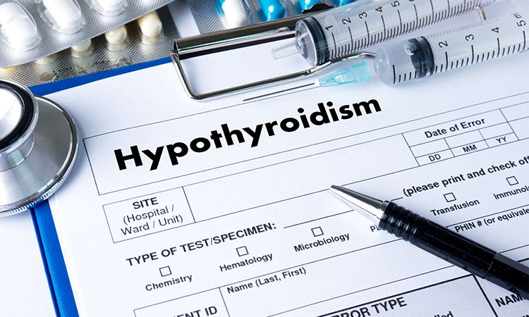 Hypothyroidism and Hair Problems