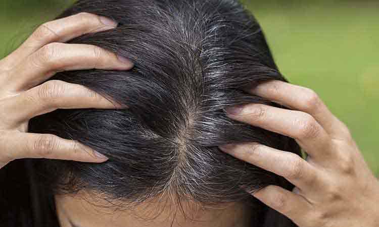 White hair treatment discount