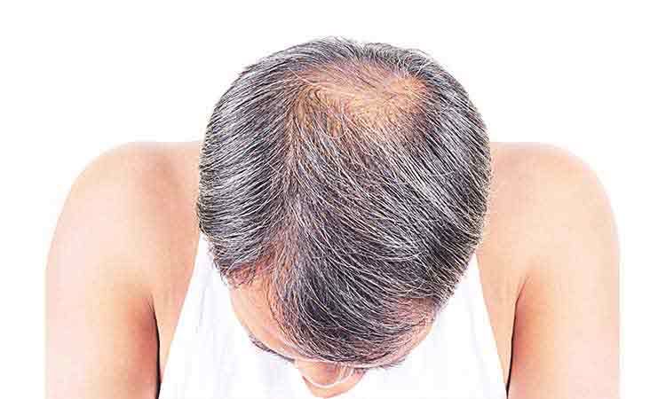 I hated to wash or comb my Hair… I hated to wash or comb my Hair…