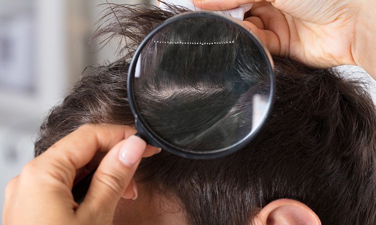 Advanced hair loss solutions for all your hair problems | Dr Batra's™