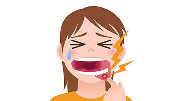 What causes Lichen Planus in the mouth?