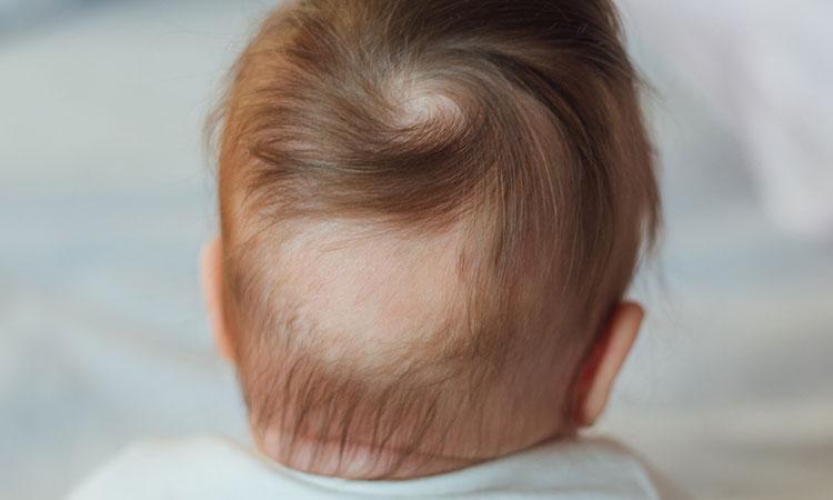 Why Your Baby is Losing Hair  Enfamil