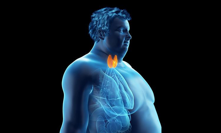 Tough time losing weight? It could be due to thyroid problem