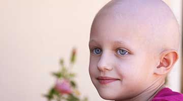 Treatment for Alopecia Areata In Children Without Side-Effects