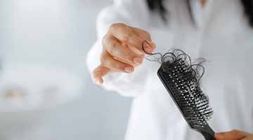 Homeopathy helps treat hair loss in women