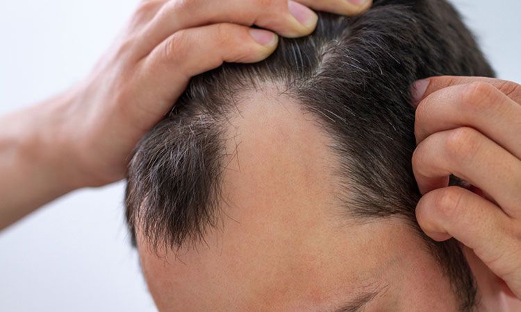If You Don't Take Hair Loss Seriously, You Don't Take Your Health Seriously  | Dr Batra's™