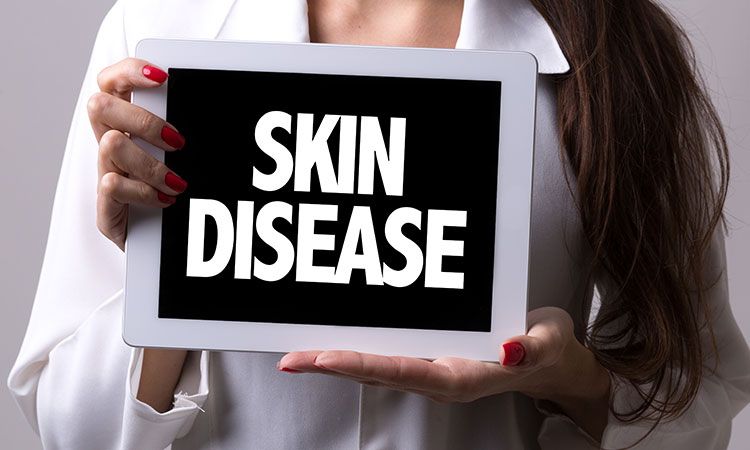  Signs that your skin needs an evaluation test.