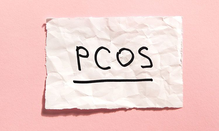 The interconnection between PCOS and weight loss