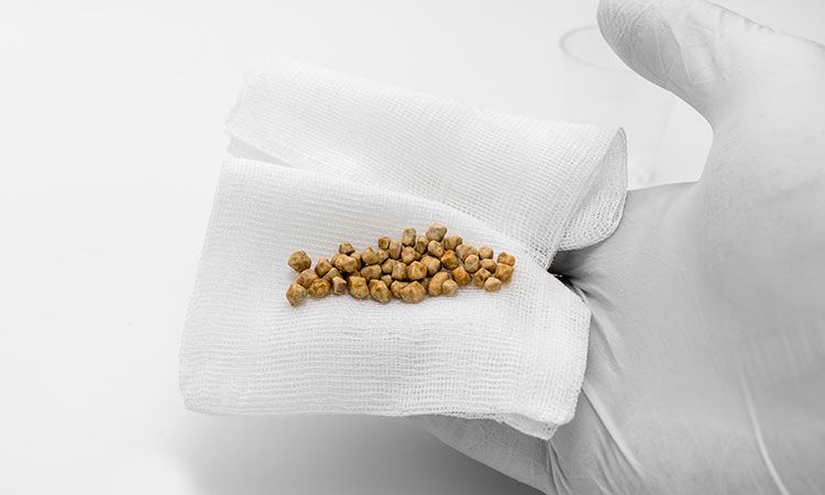 There's a basic difference between kidney stones and Cholecystitis Gallstones. Learn the same.