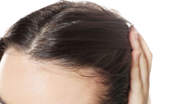 Myths about hair loss in women