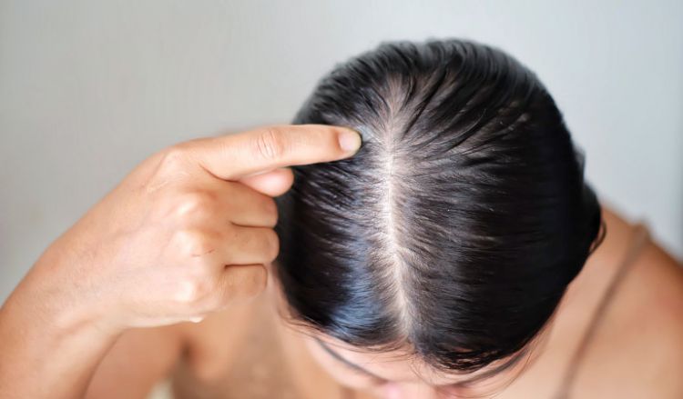Causes of hair loss in women | Dr Batra's™