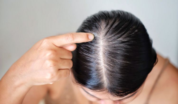 Causes of hair loss in women | Dr Batra's™ Causes of hair loss in women | Dr Batra's™