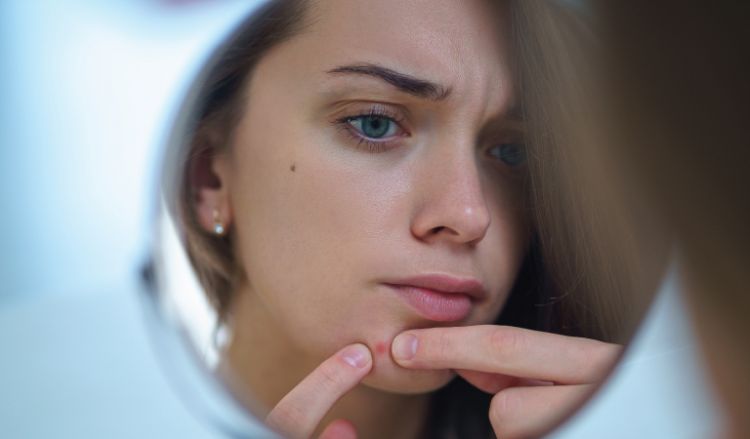 Can skin stress lead to pimples?