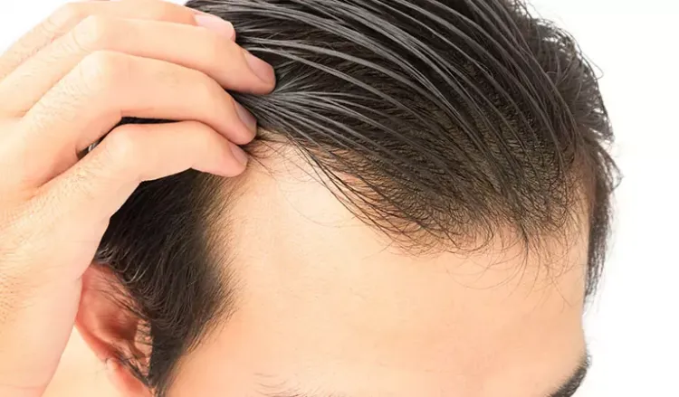 Hair Fall treatment